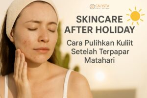 Skincare After Holiday: Cara Pulihkan Kulit Setelah Terpapar Matahari