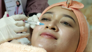 Perbedaan Collagen Stimulator dan Skinbooster: Aktifin Kolagen dengan Perawatan yang Tepat