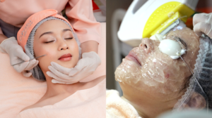 IPL vs Facial Biasa: Mana yang Lebih Efektif Cerahkan Kulit Kusam?