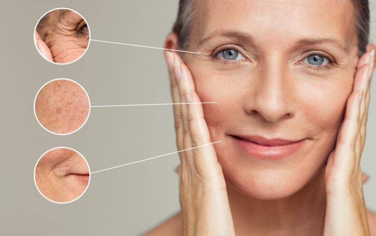 Ketahui anti-aging treatment sebelum melakukan prosedur seperti botox, filler, ataupun facelift