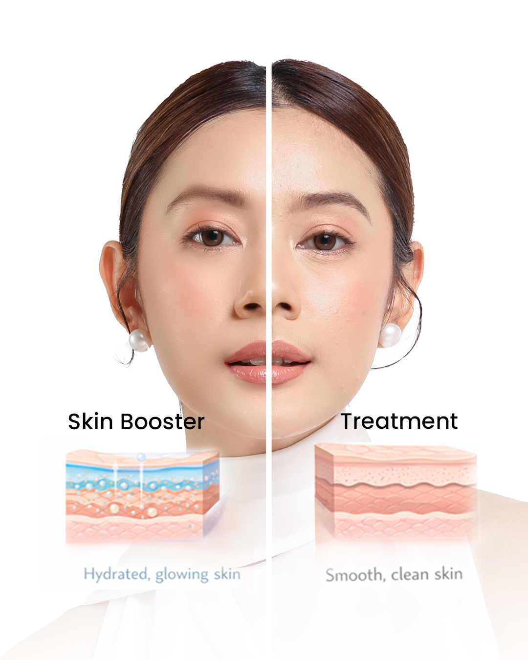 Perbedaan Skin Booster dan Treatment Lain: Mana yang Tepat untuk Kulit Anda?