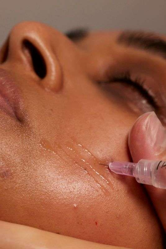 Ketahui Perbandingan Harga Skin Booster  Sebelum Treatment