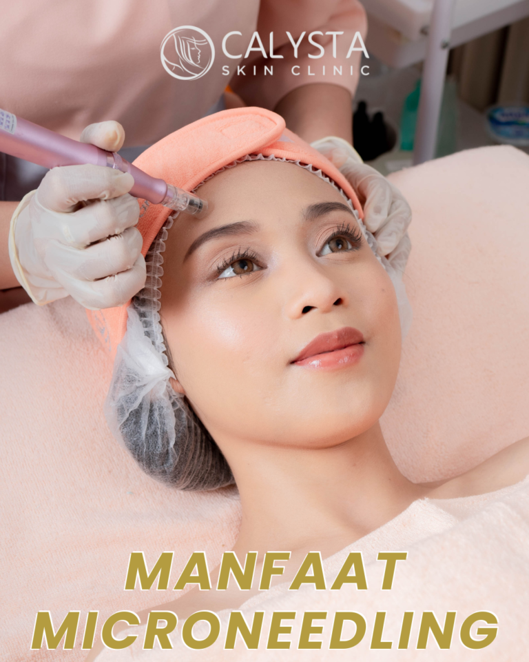 Microneedling Dermapen adalah pilihan efektif untuk memperbaiki tekstur kulit, bekas jerawat, dan tanda penuaan dini jika dilakukan oleh tenaga medis berpengalaman. Untuk hasil optimal, lakukan perawatan di klinik terpercaya yang memiliki tenaga ahli terbaik. Salah satunya ialah Calysta Clinic, dengan jaringan klinik sebanyak 16 klinik yang tersebar di Jawa Barat, Jakarta, Banten hingga Jawa Tengah, memiliki puluhan dokter yang berlisensi dan berkualitas untuk merekomendasikan treatment yang teepat untuk mengatasi kulit kusam. Didukung oleh terapis berpengalaman, serta alat yang mutakhir menjadikan pilihan untuk mengatasi permasalahan kulit menjadi lebih beragam dan efektif bagi setiap kulit.