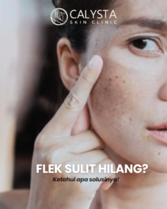 Sudah Rutin Skincare, tetapi Flek Hitam Tidak Kunjung Memudar?